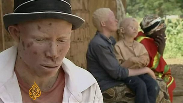 Sgominato traffico di albini africani: venivano sfruttati per far impazzire i leghisti - Lercio