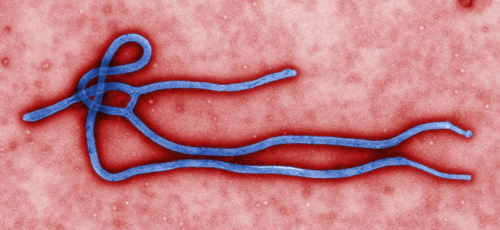 Audience in calo: rescisso contratto tra virus ebola e TG1 - Lercio