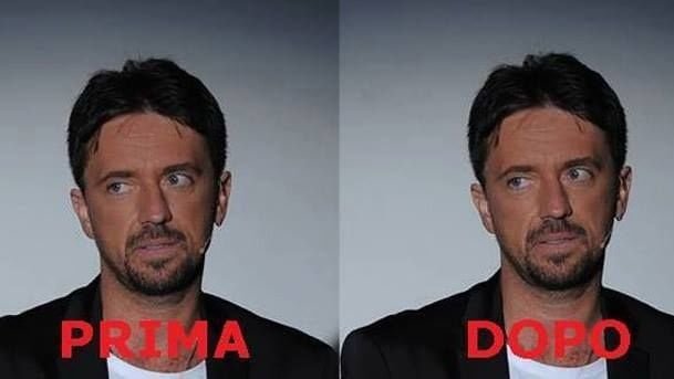 Scanzi spende 10mila euro in chirurgia estetica per somigliare a se stesso - Lercio