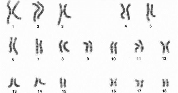 Maschilista si fa togliere tutti i cromosomi X e muore - Lercio