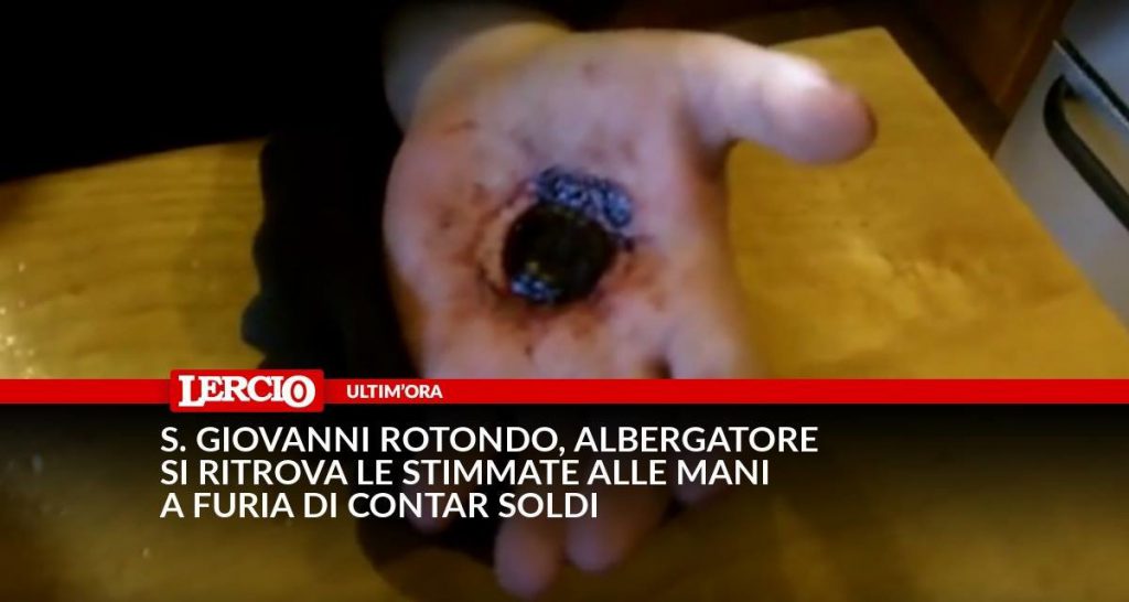 S. Giovanni Rotondo, albergatore si ritrova le stimmate alle mani a furia di contar soldi - Lercio