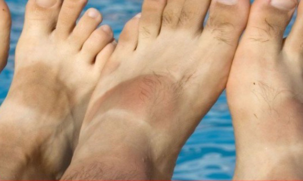 Scienziati rivelano: il Sole abbronza di più quando può lasciare segni a cazzo - Lercio