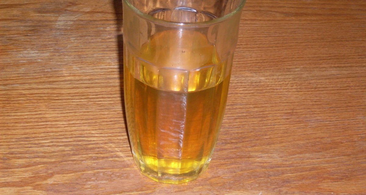 Pioniere dell'urinoterapia muore soffocato da un calcolo renale - Lercio