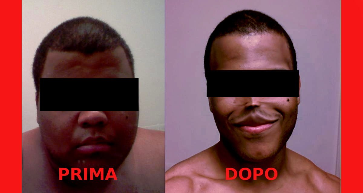 Respiriano obeso si fa chiudere il setto nasale per dimagrire - Lercio