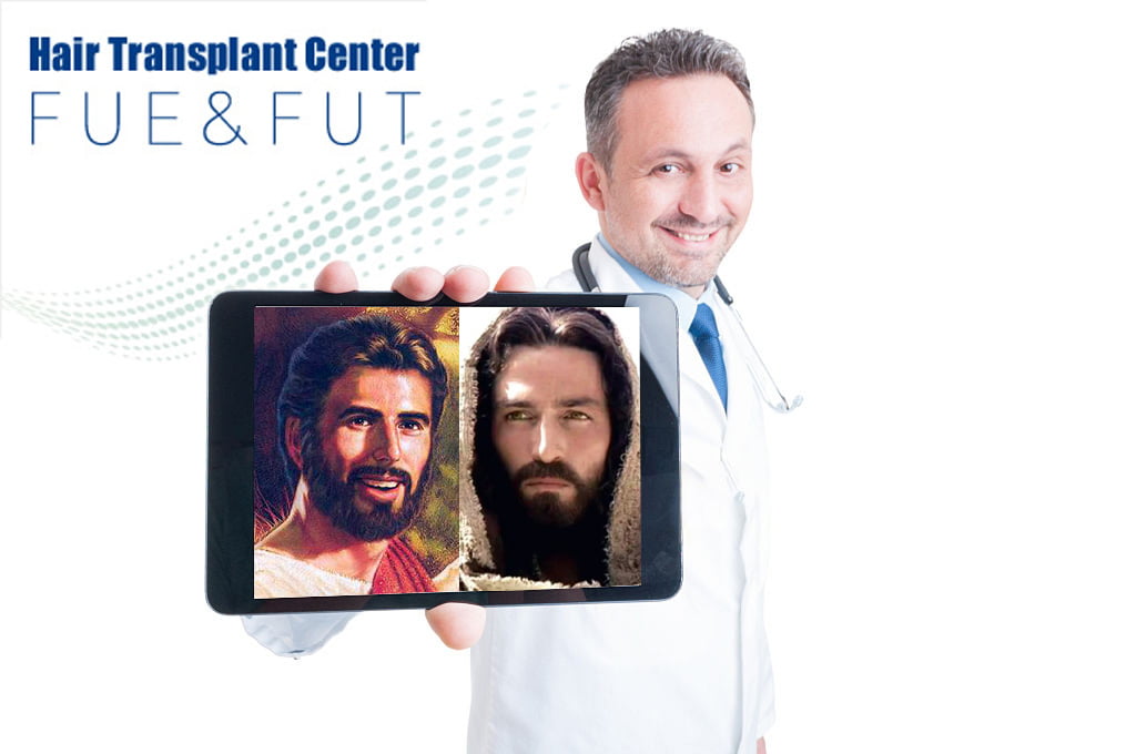 scelta hairline del papa