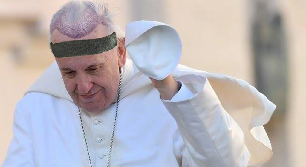 Papa trapianto testa