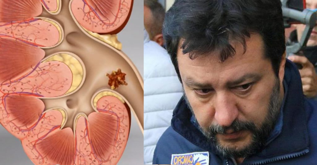 "È stata un'esperienza terribile". Parla il malore avuto da Salvini - Lercio